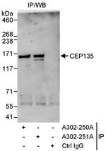 CEP135 Antibody in Immunoprecipitation (IP)