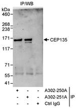 CEP135 Antibody in Immunoprecipitation (IP)