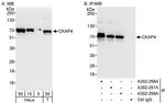CKAP4 Antibody in Western Blot (WB)