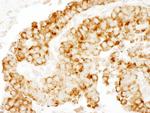 CKAP4 Antibody in Immunohistochemistry (Paraffin) (IHC (P))