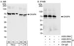 CKAP4 Polyclonal Antibody
