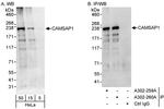 CAMSAP1 Polyclonal Antibody