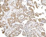 SET Antibody in Immunohistochemistry (Paraffin) (IHC (P))