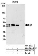 SET Antibody in Immunoprecipitation (IP)