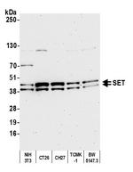 SET Antibody in Western Blot (WB)
