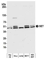 SET Antibody in Western Blot (WB)