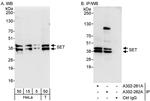 SET Antibody in Western Blot (WB)