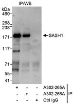SASH1 Antibody in Immunoprecipitation (IP)