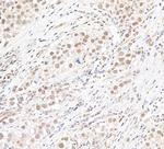 MLLT1 Polyclonal Antibody