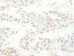 BTBD12 Polyclonal Antibody