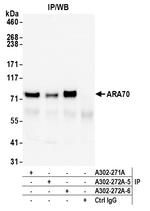ARA70 Antibody in Immunoprecipitation (IP)