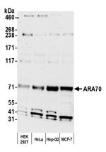 ARA70 Polyclonal Antibody