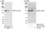 PGC-1beta Polyclonal Antibody