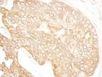 p600 Polyclonal Antibody