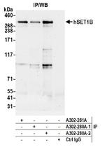 hSET1B Polyclonal Antibody