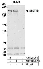 hSET1B Polyclonal Antibody