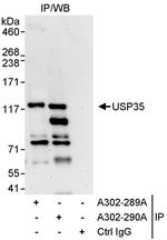USP35 Polyclonal Antibody