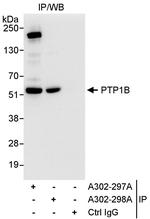 PTP1B Polyclonal Antibody