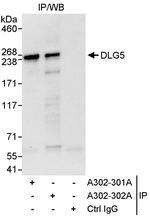 DLG5 Polyclonal Antibody
