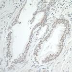 BRD7 Antibody in Immunohistochemistry (Paraffin) (IHC (P))