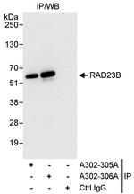 RAD23B Antibody in Immunoprecipitation (IP)