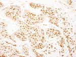 RAD23B Antibody in Immunohistochemistry (Paraffin) (IHC (P))