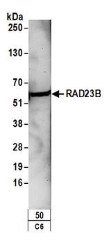 RAD23B Antibody in Western Blot (WB)