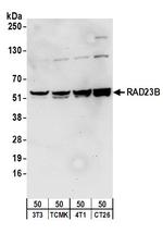 RAD23B Antibody in Western Blot (WB)