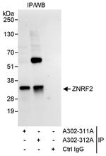 ZNRF2 Polyclonal Antibody