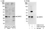 ZNRF2 Polyclonal Antibody