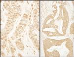 BTF3 Polyclonal Antibody