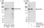 NUP188 Polyclonal Antibody