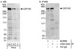 CEP192 Antibody in Western Blot (WB)