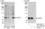 CEP76 Antibody in Western Blot (WB)