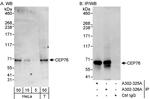 CEP76 Polyclonal Antibody