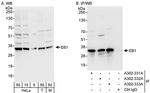 EB1 Antibody in Western Blot (WB)