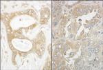 EB1 Polyclonal Antibody