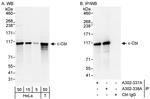 c-Cbl Antibody in Western Blot (WB)