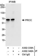 PRCC Antibody in Immunoprecipitation (IP)
