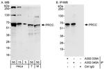 PRCC Polyclonal Antibody