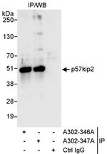 p57kip2 Antibody in Immunoprecipitation (IP)