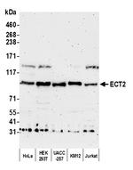 ECT2 Polyclonal Antibody