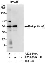 Endophilin A2 Polyclonal Antibody