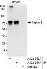 Septin 9 Antibody in Immunoprecipitation (IP)