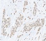 Pc2 Antibody in Immunohistochemistry (Paraffin) (IHC (P))