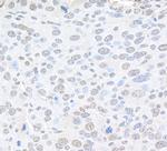 Pc2 Polyclonal Antibody