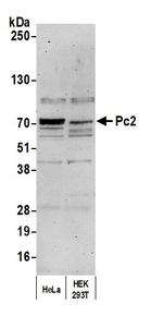 Pc2 Antibody in Western Blot (WB)