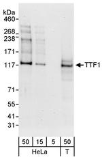 TTF1 Polyclonal Antibody