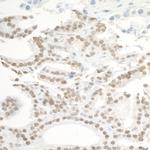 BRD3 Polyclonal Antibody