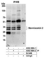 Stanniocalcin 2 Antibody in Immunoprecipitation (IP)